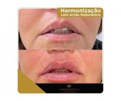 Preenchimento Labial em Guarulhos