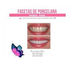 FACETAS PORCELANA GOIANIA GOIAS